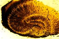 Hippocampus impregnated by the Golgi stain