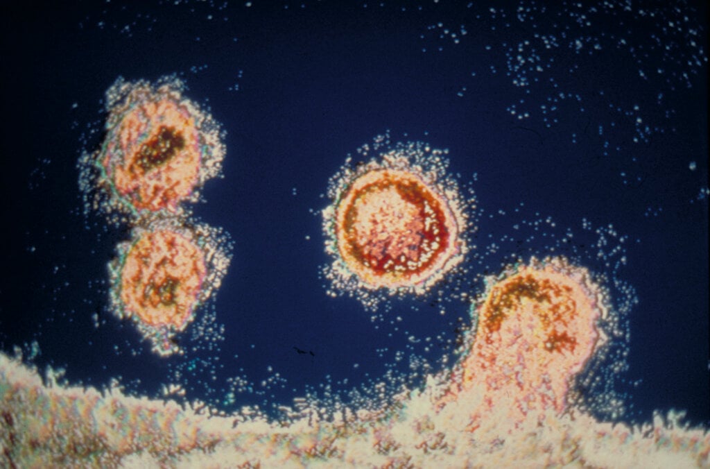 FrancoiseBarre Sinoussi DISCOVERY asset15