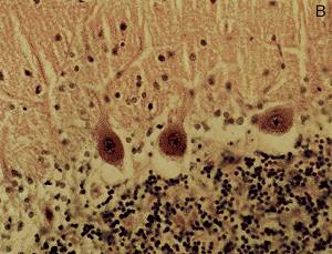 The cerebellar cortex in a routine histological stain